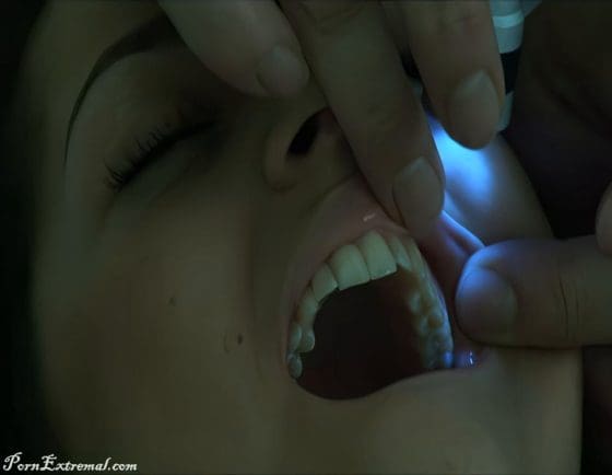 Dental Strangler 2 - Crime Scene Investigation.0019